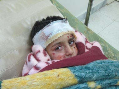 A child in a field hospital in Aleppo, Syria after sustaining injuries in a cluster bomb attack by the Syrian armed forces on a residential area on March 1, 2013.