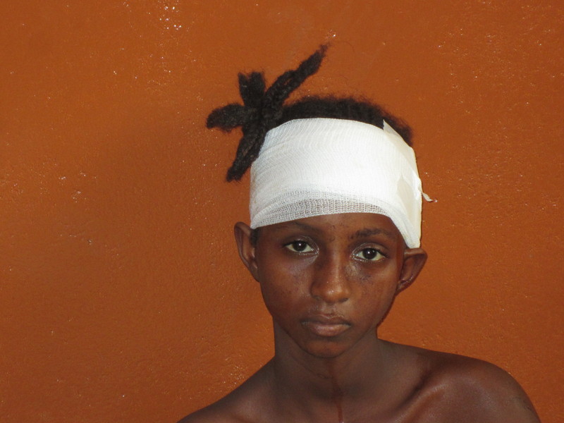 Eleven-year-old Fati suffered deep machete wounds to her head and arm in an attack by anti-balaka militia in Boali. Six people were killed and 20 others were injured in the same attack (Photo Credit: Amnesty International).